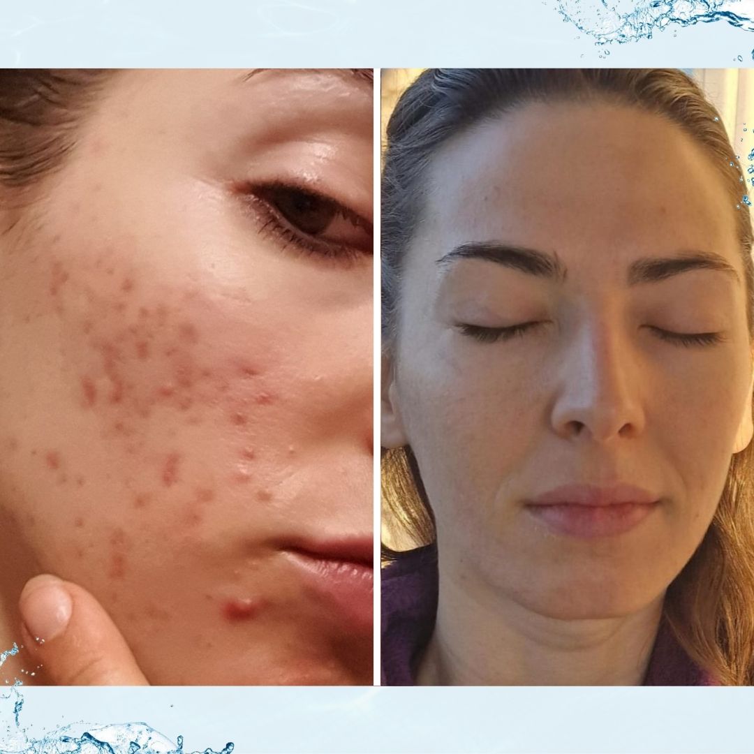 FAMILY PACK: Enlight ANTI - AGE VODIK boca 280 ml 2+1 GRATIS - Enlight Shop